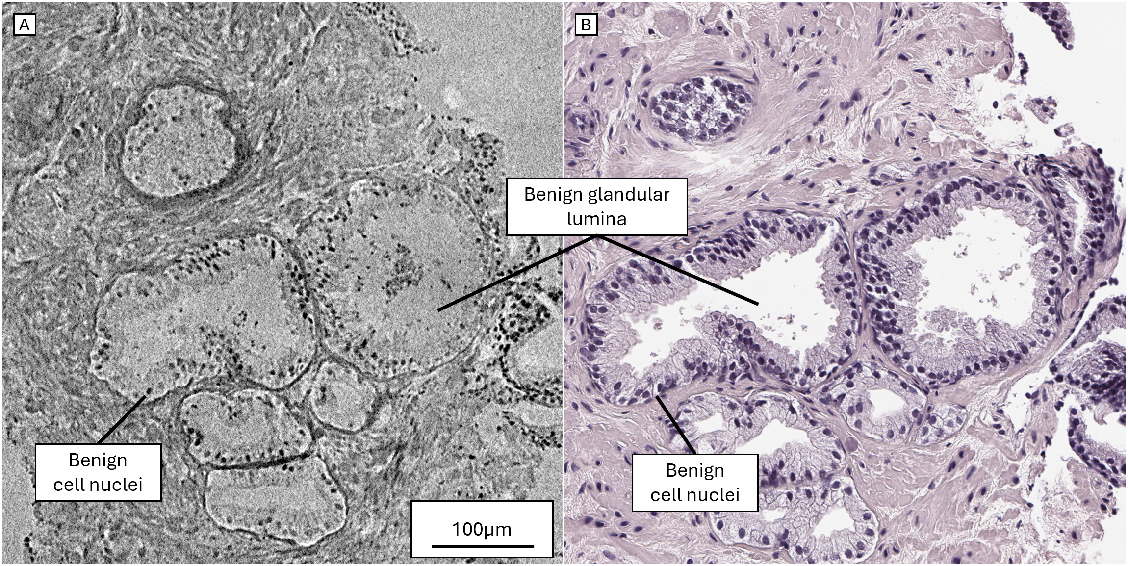 Human FFPE virtual histology (placeholder)